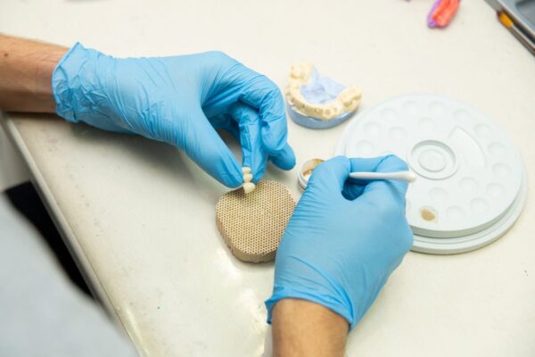 Todo lo que necesitas saber sobre el precio de los implantes dentales