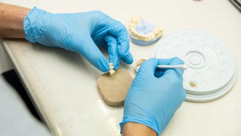Todo lo que necesitas saber sobre el precio de los implantes dentales