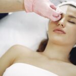 chemical peel treatment