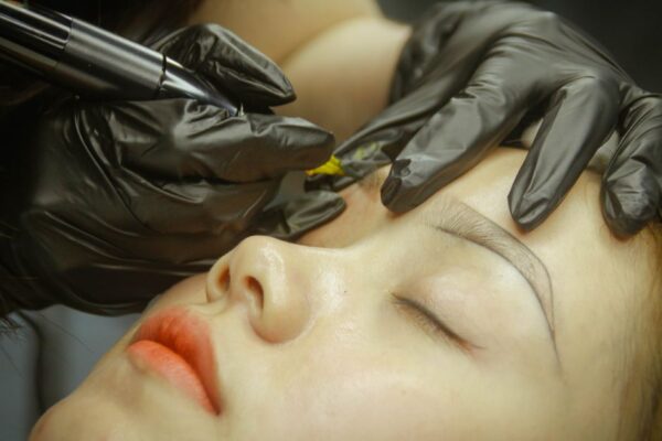 La guía definitiva para la eliminación de tatuajes con láser