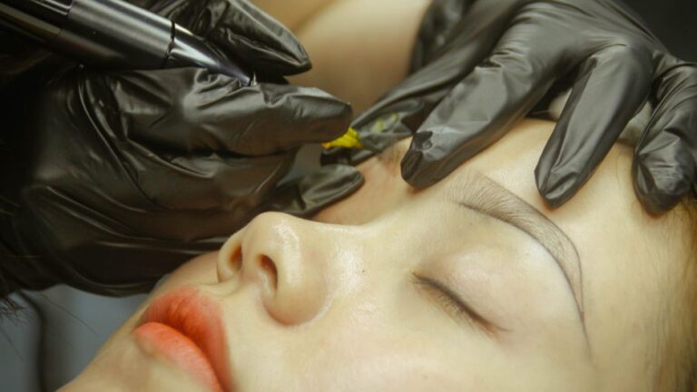 La guía definitiva para la eliminación de tatuajes con láser